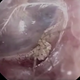 Imagen para el artículo titulado Acude al médico por un extraño picor en la cabeza y le encuentran una araña anidando en el interior del oído